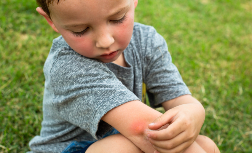 Traveller’s Guide to Infected Insect Bites: Tips for Staying Safe in Bug-Prone Areas