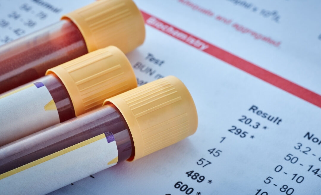 An illustration of blood tests and report signifying Private Blood Tests.