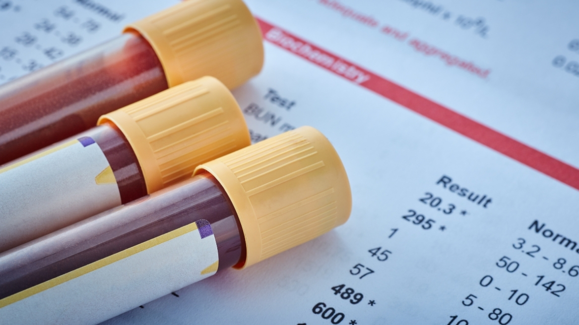 An illustration of blood tests and report signifying Private Blood Tests.