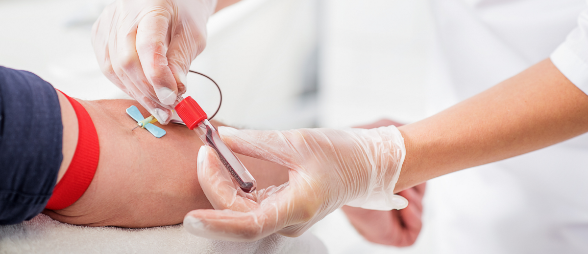 Blood Checkup Longfield Dartford Gravesend