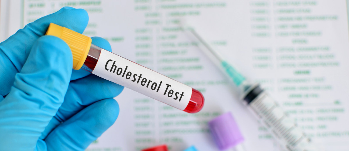 Why you should get a pharmacy cholesterol test