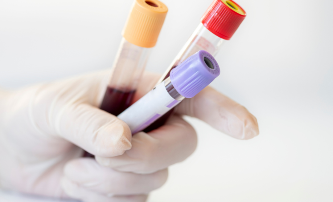 What to Expect During a Private Blood Test