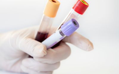 What to Expect During a Private Blood Test: A Step-by-Step Guide