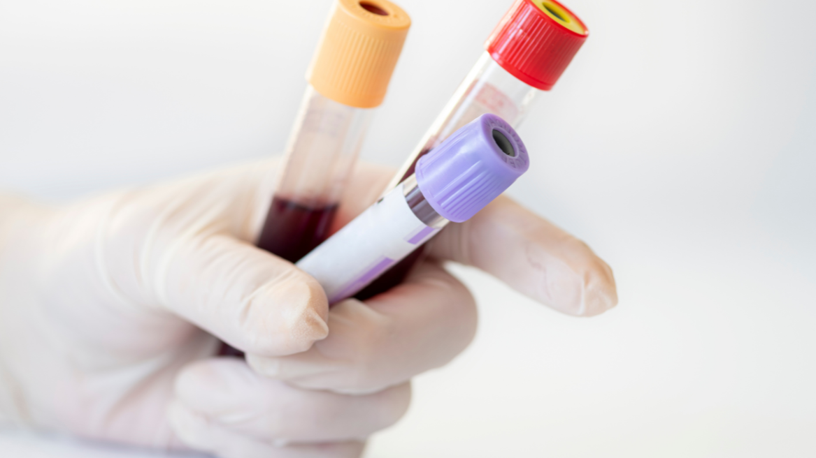 What to Expect During a Private Blood Test